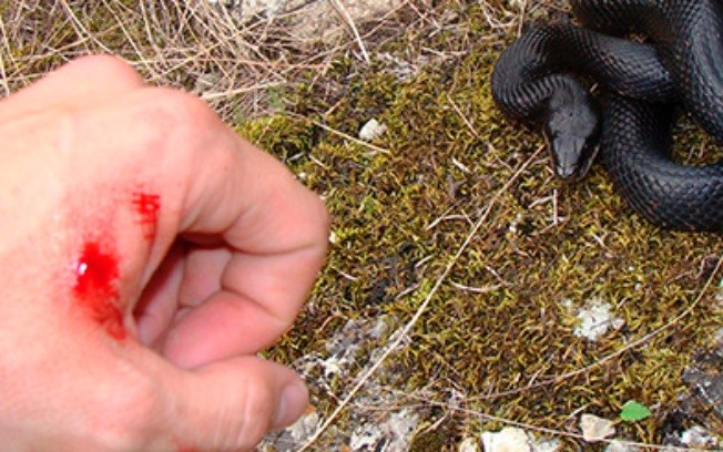 Casos envolvendo cobras, escorpiões e aranhas devem ser tratados rapidamente em hospitais, únicos locais onde há soro antiveneno