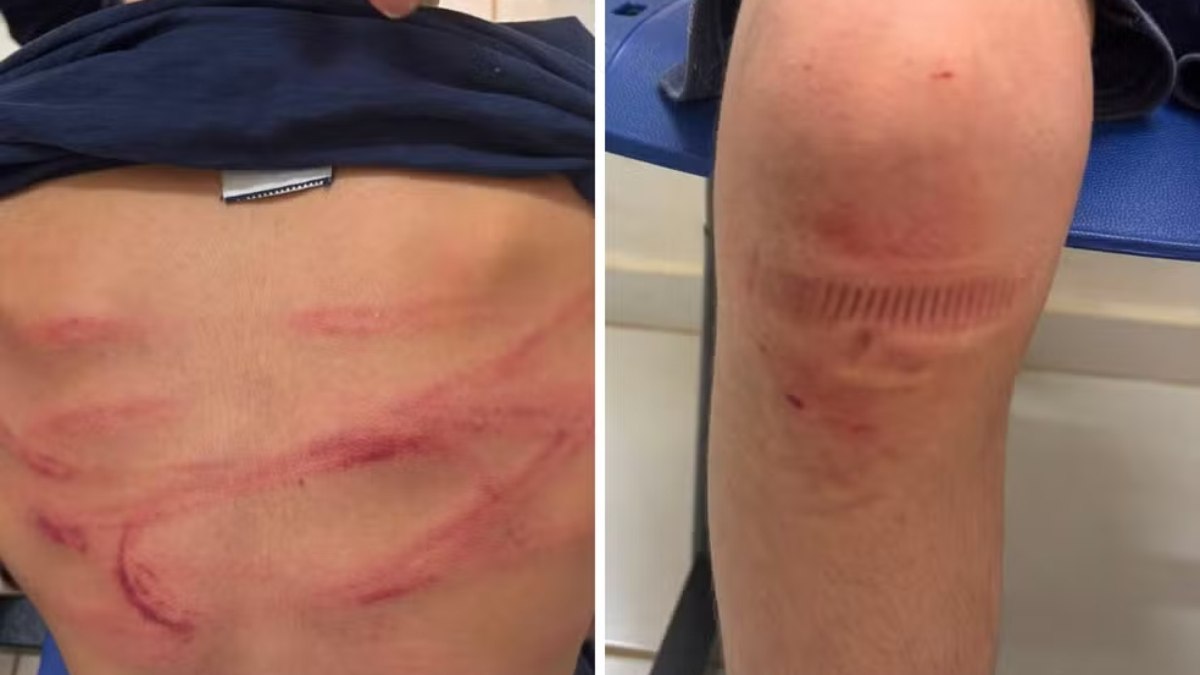 Homem é preso após agredir e torturar enteado de 12 anos Homem é preso após agredir e torturar enteado de 12 anos