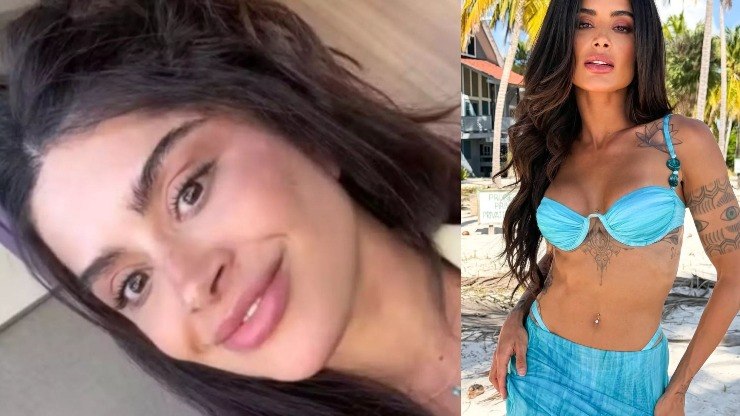 Ex-BBB Aline Campos realiza nova plástica no mesmo dia do lifting