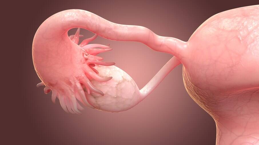 Com a nova técnica, óvulos são coletados após retirada do ovário do corpo da mulher