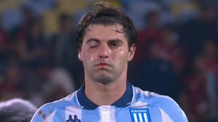 Destaque do Racing passa por cirurgia após jogo contra o Flamengo