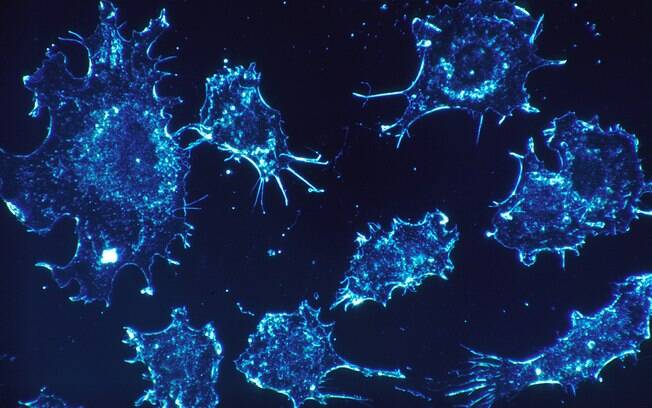 Células infectadas acabaram morrendo após o tratamento com o vírus modificado