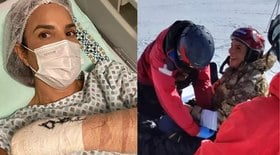 Ivete Sangalo posta vídeo de acidente após cirurgia