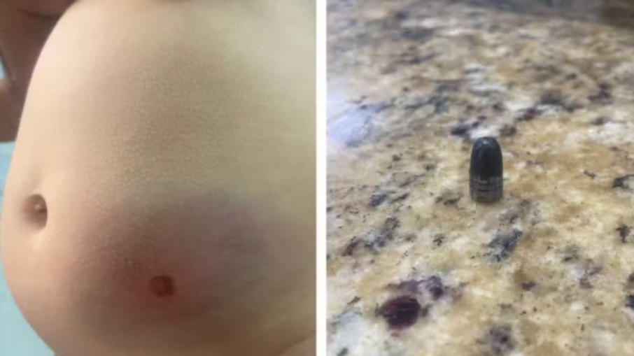 Bebê é atingida por bala perdida em São Paulo Bebê é atingida por bala perdida em São Paulo