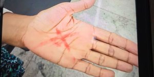 Mulher comunica pedido de socorro com “X” na mão e marido é preso