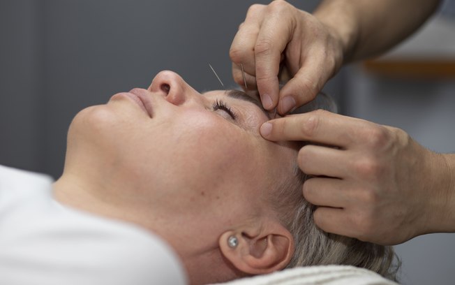 Mercado de trabalho para Acupunturistas avança no Brasil