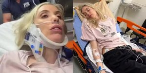 Filhos salvam comediante grave acidente doméstico quase a matar