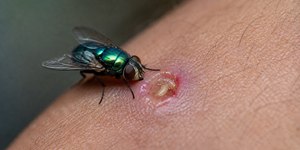 Surto de larva da mosca-varejeira deixa 2 mortos e 141 infectados