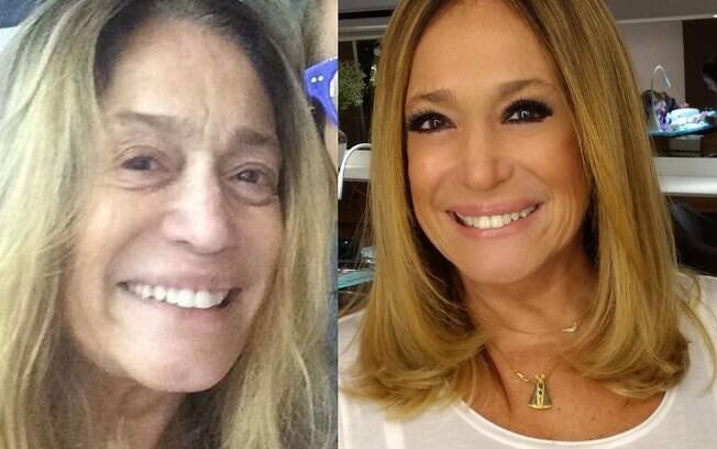 Susana Vieira posou faz parte da lista de famosas sem maquiagem