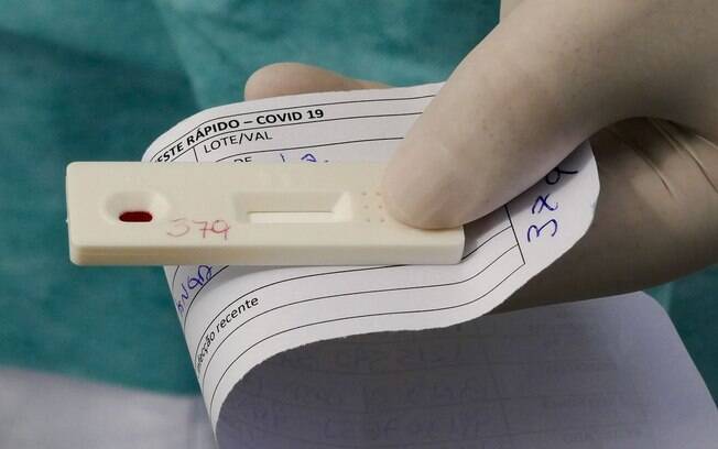A partir do 8º dia de infecção, o teste é capaz de indicar os que são produzidos em fases mais tardias ou após a recuperação