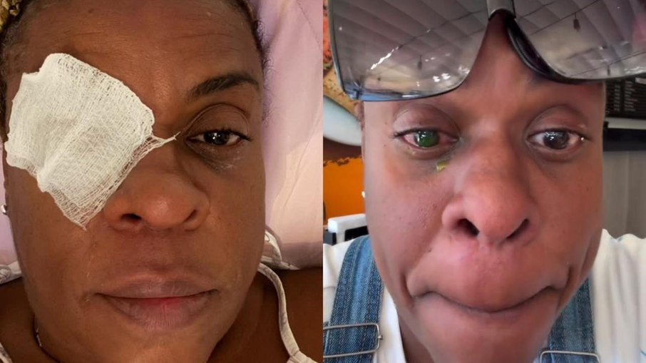 Cacau Protásio desabafa após perda de visão: 'O barato sai caro'