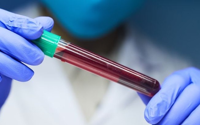 Exame de sangue detecta câncer em 2 horas