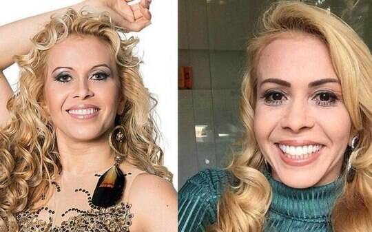 Joelma faz botox, tem sorriso e nariz novos, mas se recusa 