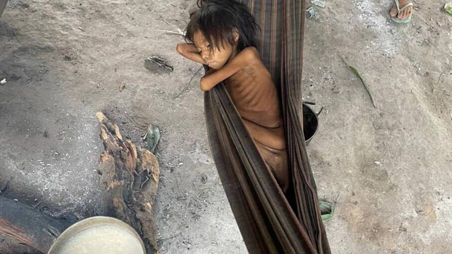 Com quadro de verminose e malária, criança yanomami dorme em rede na aldeia Maimasi , Terra Indígena Yanomami, em Roraima