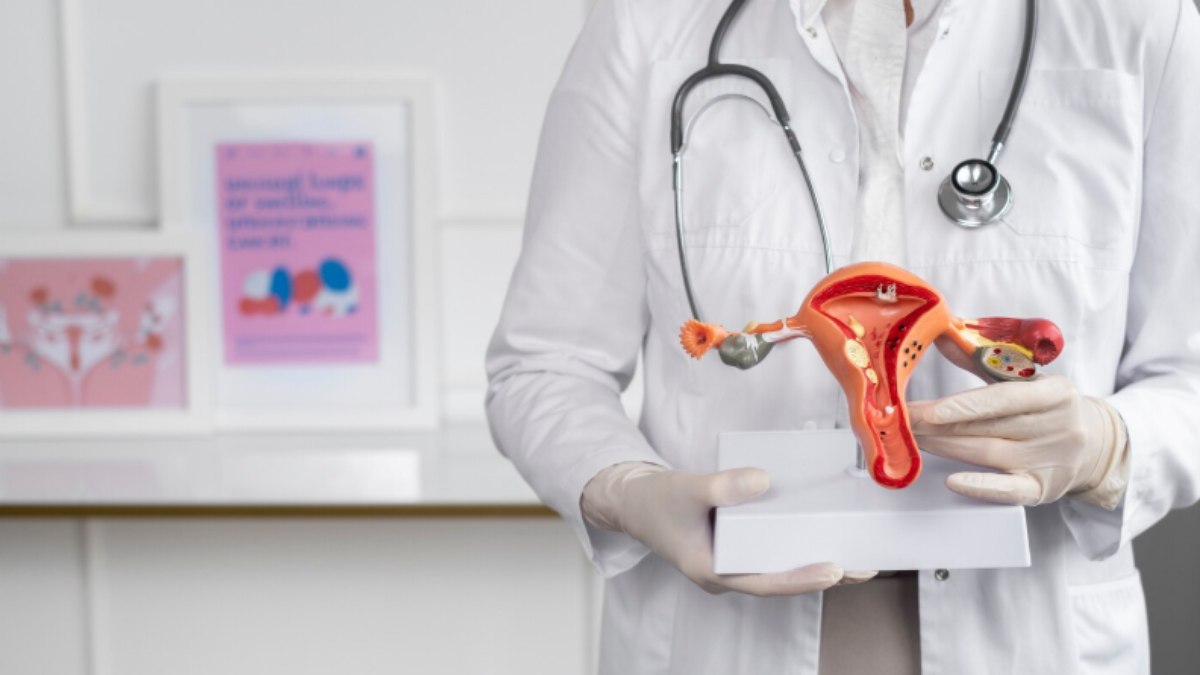 Como tratar adenomiose Como tratar adenomiose