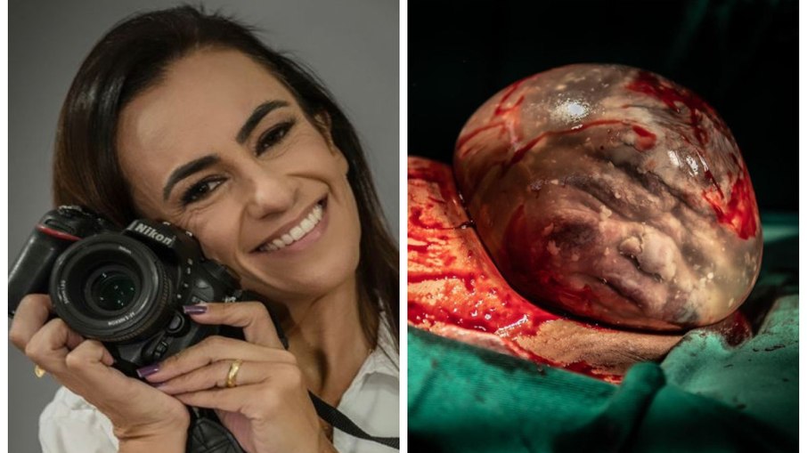 Ludmila Gusman já fotografou oito bebês empelicados.