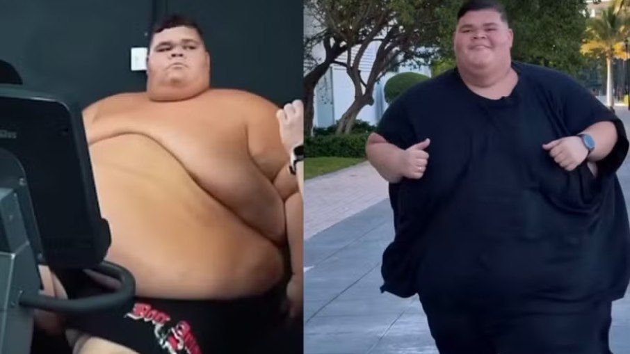 Gordão da XJ perde 75 kg e desabafa sobre saúde mental Gordão da XJ perde 75 kg e desabafa sobre saúde mental
