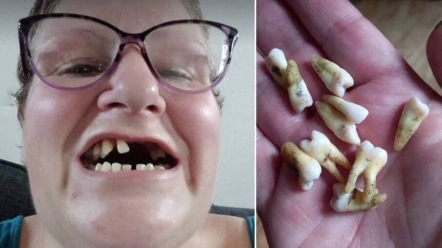 Danielle Watts arrancou sozinha 11 dentes