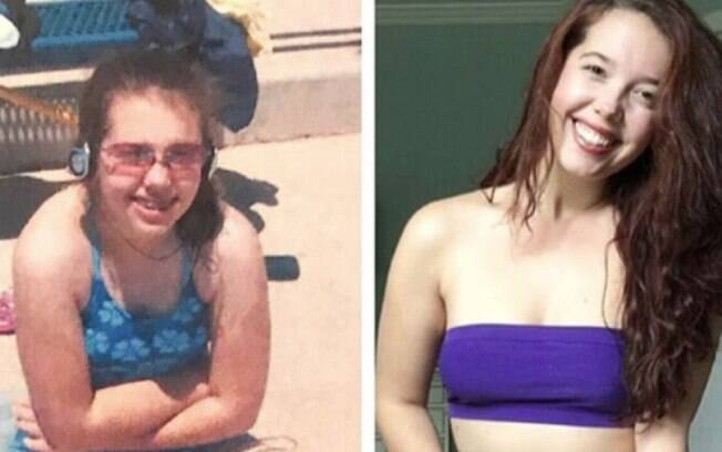 A Rachel de 13 anos acreditava que seu corpo não era merecedor de estar em fotografias para ser lembrado no futuro
