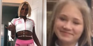 Mulher de 19 anos admite arrependimento por vício em bronzeamento