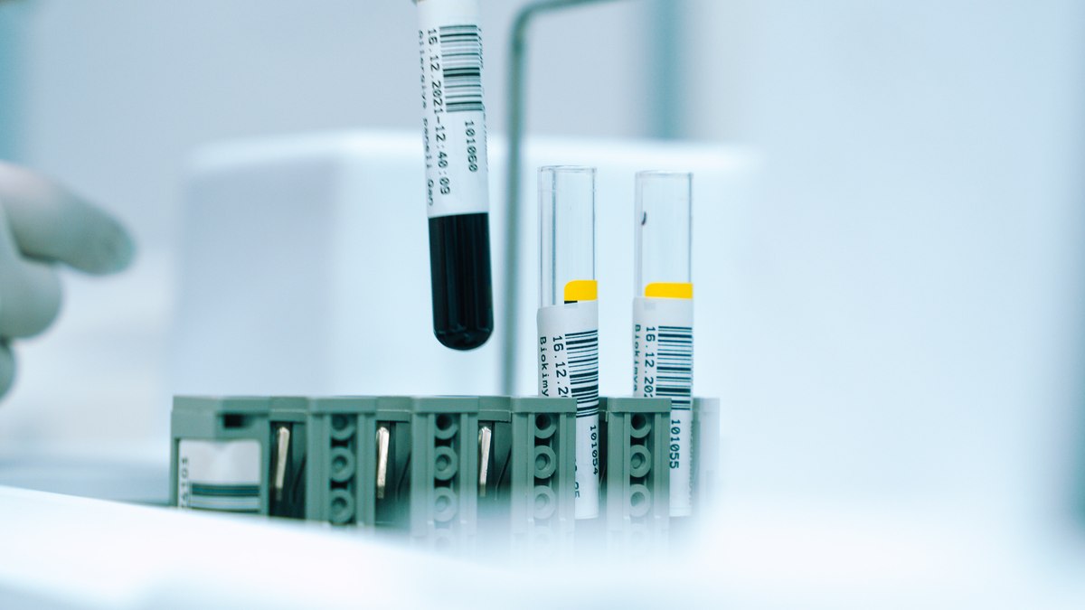 Laboratório coleta amostras de sangue para exames