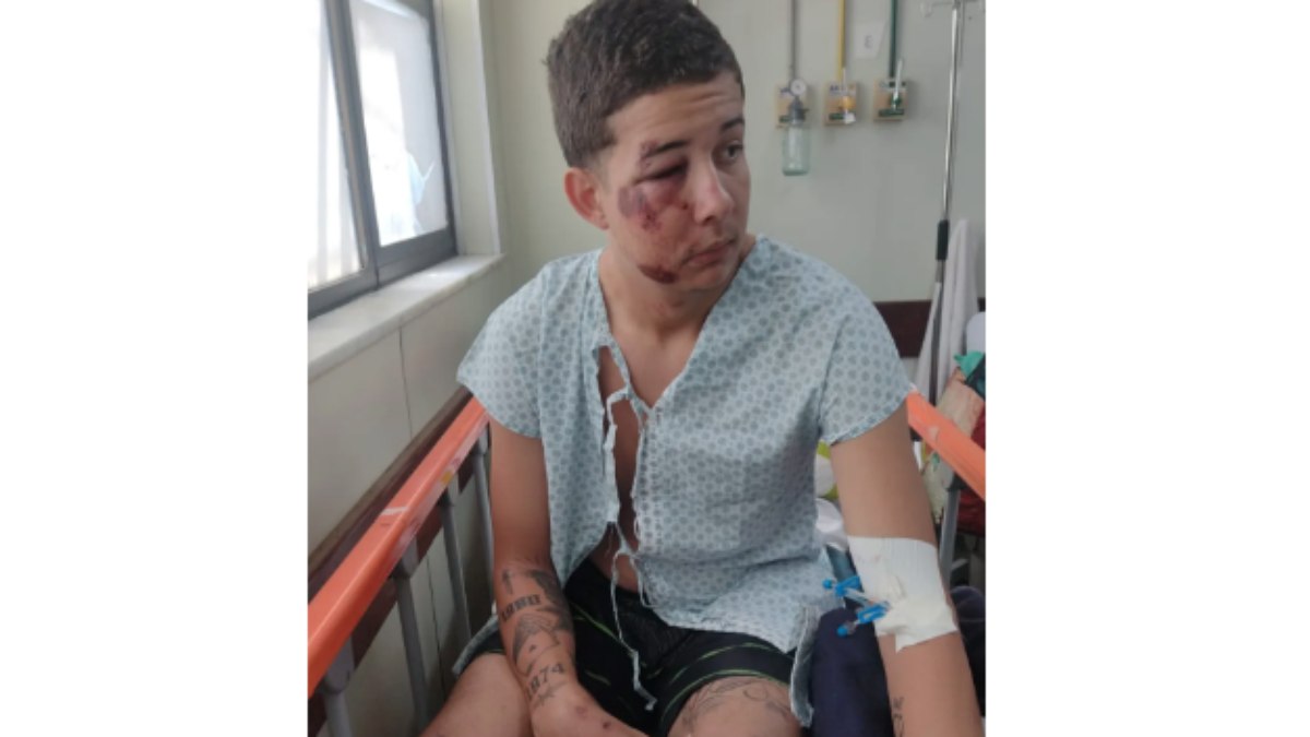 Renato de Araújo Sardinha Filho, 18, estudante, agredido em um bloco de carnaval, em Campo Grande, na Zona Oeste do Ri
