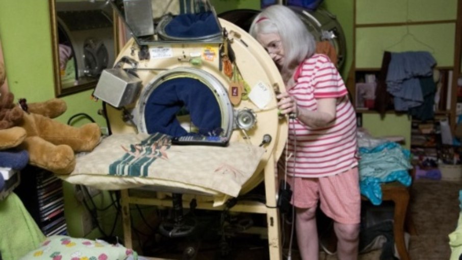 Martha Lillard ao lado de seu pulmão de aço adaptado. Após anos de treinamento e adaptação, ela conseguiu passar períodos fora da máquina, utilizando outros recursos de ventilação, mas continuou dependendo do equipamento para respirar com segurança ao longo da vida. Martha Lillard ao lado de seu pulmão de aço adaptado. Após anos de treinamento e adaptação, ela conseguiu passar períodos fora da máquina, utilizando outros recursos de ventilação, mas continuou dependendo do equipamento para respirar com segurança ao longo da vida.