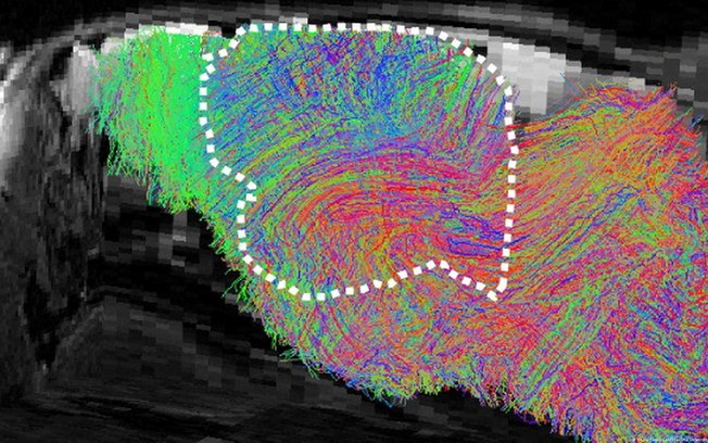 Os cientistas criaram organoides a partir de células da pele e do sangue reprogramadas em células-tronco. Depois do transplante, o tecido humano formou redes neurais funcionais no cérebro dos ratos. Os cientistas criaram organoides a partir de células da pele e do sangue reprogramadas em células-tronco. Depois do transplante, o tecido humano formou redes neurais funcionais no cérebro dos ratos.