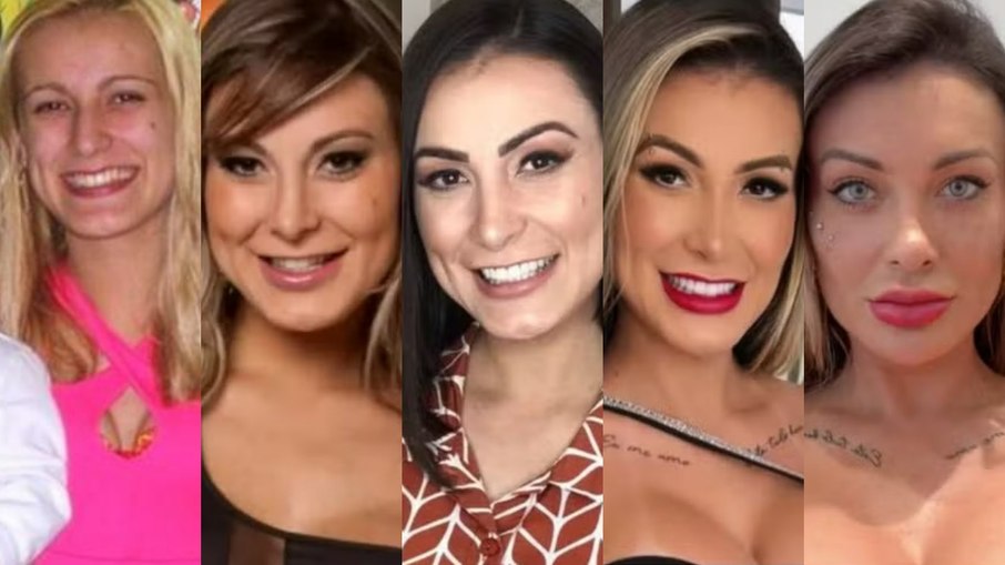 Antes e depois de Andressa Urach