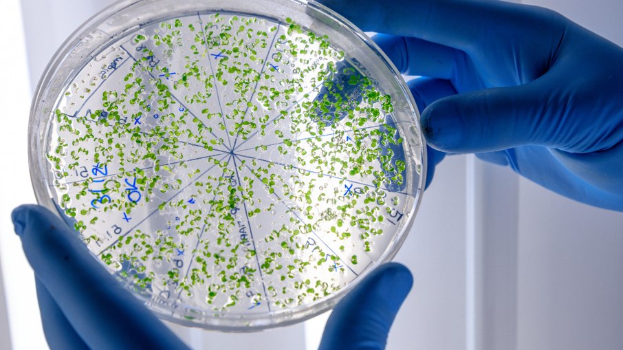 Superbactérias matam mais no Brasil por falta de tratamento