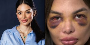 "Ia morrer ali", conta mulher agredida por empresário em SP