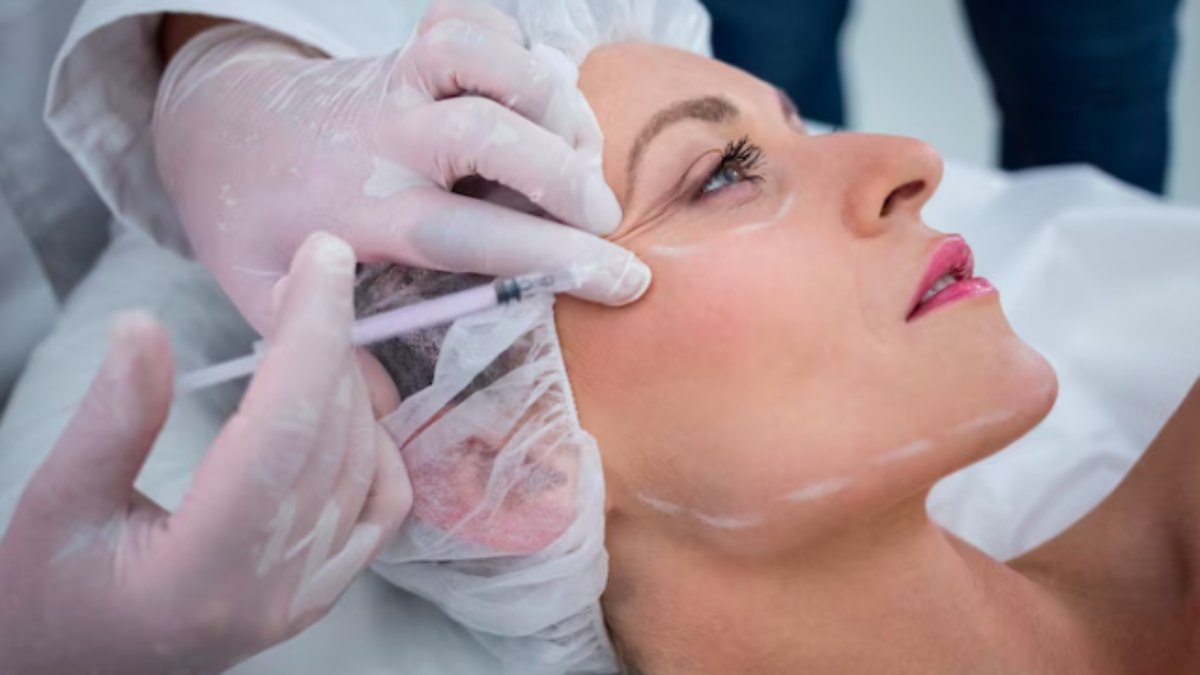 Bioestimuladores são alternativas ao lifting facial 