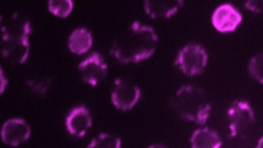 Arqueias produtoras de metano da espécie Methanosarcina acetivorans, capazes de interpretar o códon UAG tanto como sinal de parada quanto como instrução para continuar a produção de proteínas. Arqueias produtoras de metano da espécie Methanosarcina acetivorans, capazes de interpretar o códon UAG tanto como sinal de parada quanto como instrução para continuar a produção de proteínas.