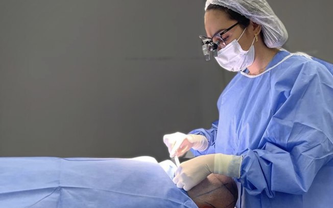Transplantes capilares têm alta de mais de 250% em 11 anos