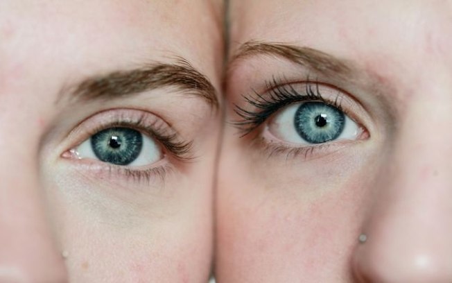 O que acontece se um gêmeo usar Botox e o outro não?
