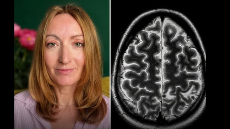Lowri compartilha sua história para conscientizar outras pessoas sobre a doença Lowri compartilha sua história para conscientizar outras pessoas sobre a doença