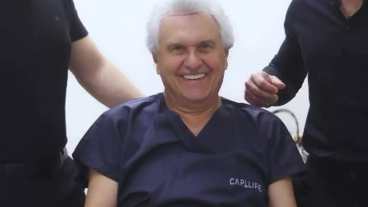 Ronaldo Caiado, governador de Goiás, faz transplante capilar