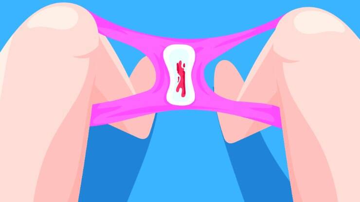 Menstruação: fluxo intenso é normal? Ginecologista esclarece