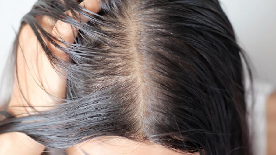 Oleosidade nos cabelos 