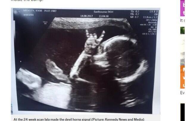 A criança fez o icônico sinal do rock enquanto tinha 24 semanas, ainda no útero da mãe. A foto foi divulgada na web