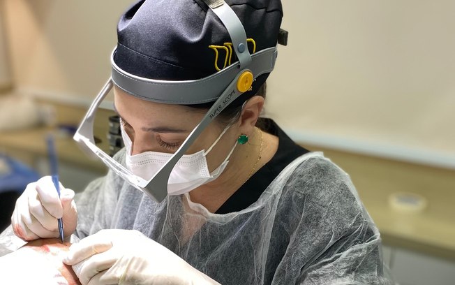Busca por transplante capilar dispara em todo o mundo