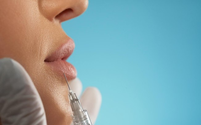Técnica Safe Lips reduz riscos no preenchimento labial Técnica Safe Lips reduz riscos no preenchimento labial