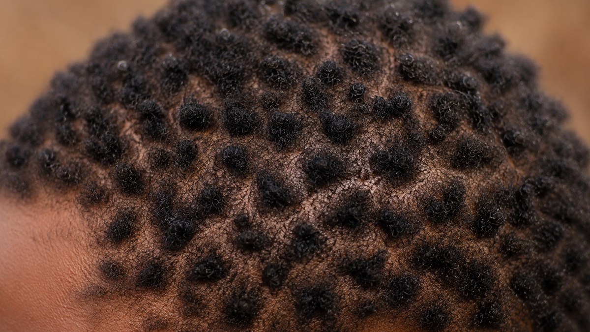 O cabelo raro africano que parece feito de “pontos”