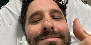 Rafinha Bastos sofre acidente de bicicleta: "Apaguei"