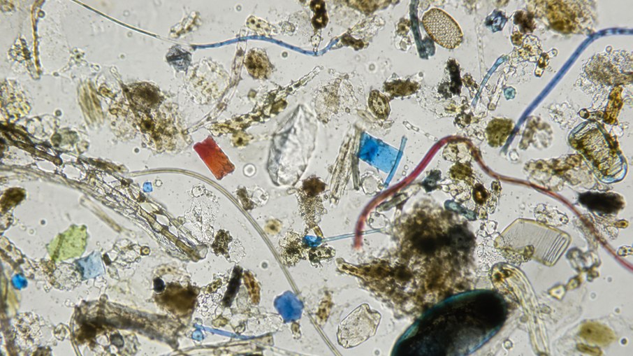 Microplásticos no sistema reprodutivo: cientistas encontraram material tóxico no sêmen, fluido folicular, placenta, líquido amniótico, cordão umbilical, sangue materno e mecônio Microplásticos no sistema reprodutivo: cientistas encontraram material tóxico no sêmen, fluido folicular, placenta, líquido amniótico, cordão umbilical, sangue materno e mecônio