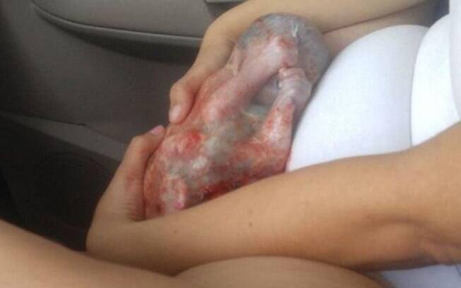 A mãe Realin Scurry faz o próprio parto dentro do carro e bebê nasce dentro da bolsa amniótica