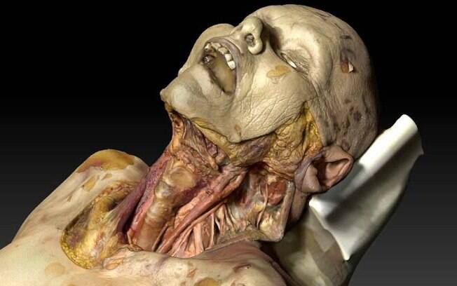 Cientistas da Faculdade de Medicina de Montpellier desenvolveram cadáver virtual para ajudar no estudo de anatomia 