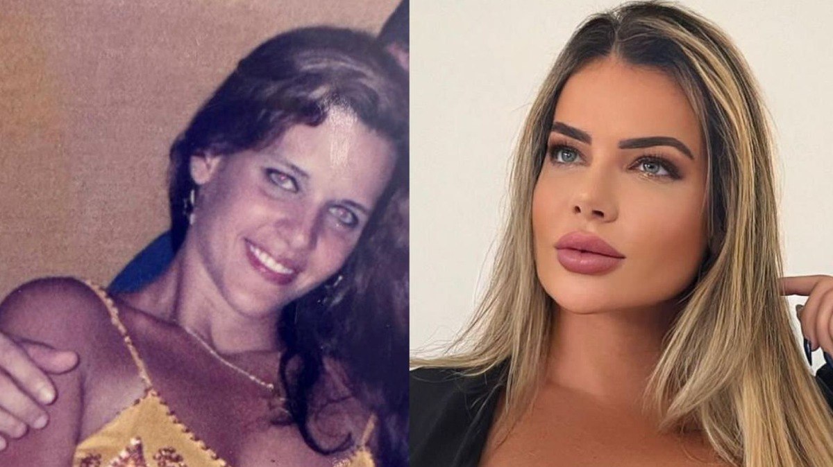 Denise Rocha choca com antes e depois e revela gasto de R$ 600 mil