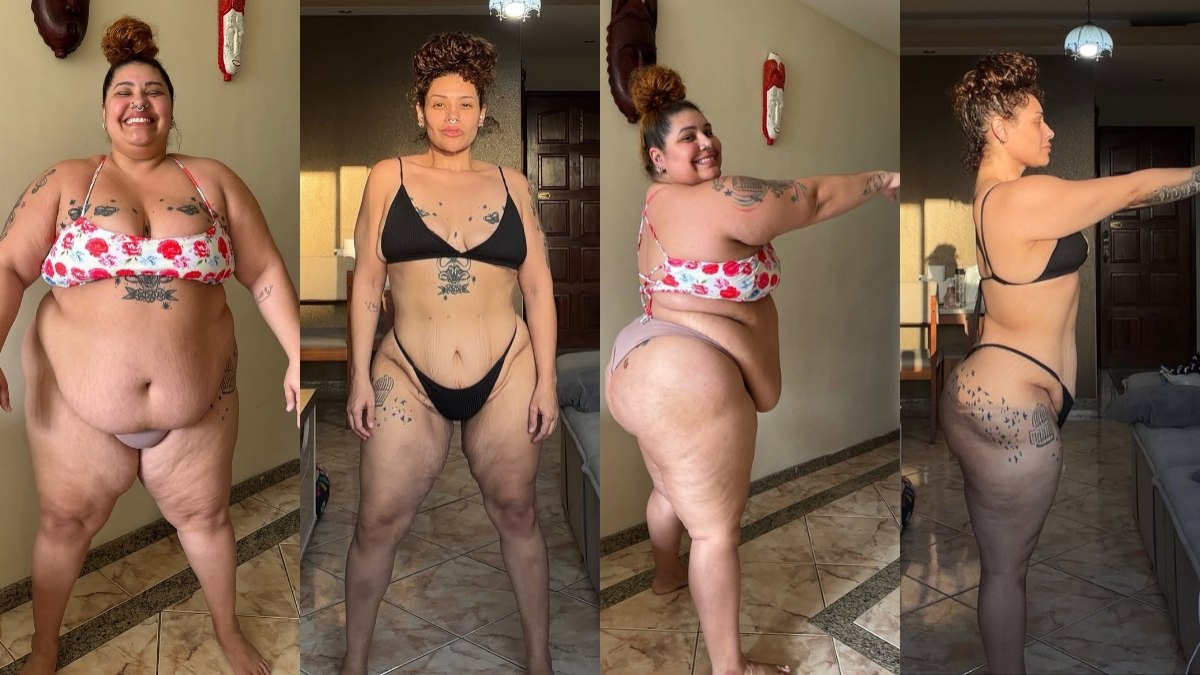 Aila Menezes mostrou a transformação após perder 90 kg e passar por uma abdominoplastia Aila Menezes mostrou a transformação após perder 90 kg e passar por uma abdominoplastia