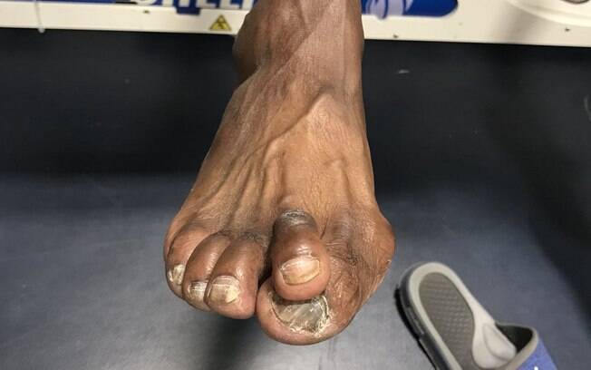 Dirk Nowitzki, atleta do Dallas Mavericks, postou foto do pé estranho de Darrell Armstrong